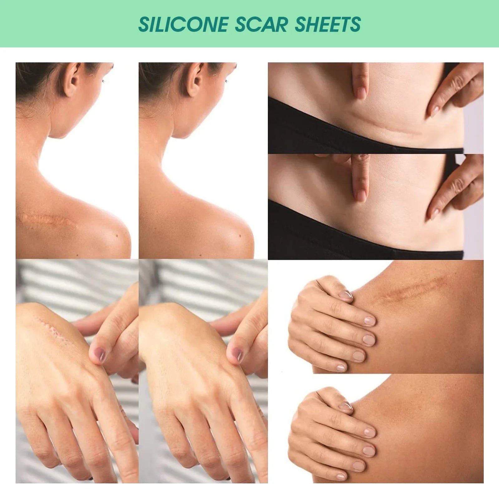 Smooth & Invisible Scar Sheets